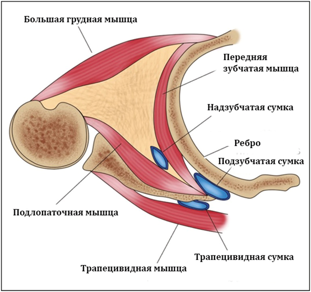 Схематическое изображение мышц и сумок, участвующих в синдроме щелкающей лопатки